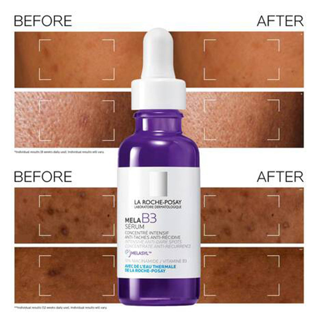 La Roche-Posay Mela B3 Serum 30ml Bottle