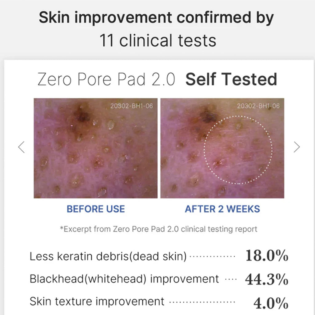 Medicube Zero Pore 2.0 Toner Pad 70pc Tub