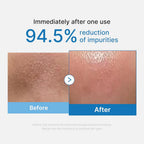 Medicube Zero Pore Blackhead Cleansing Oil 205ml Tube