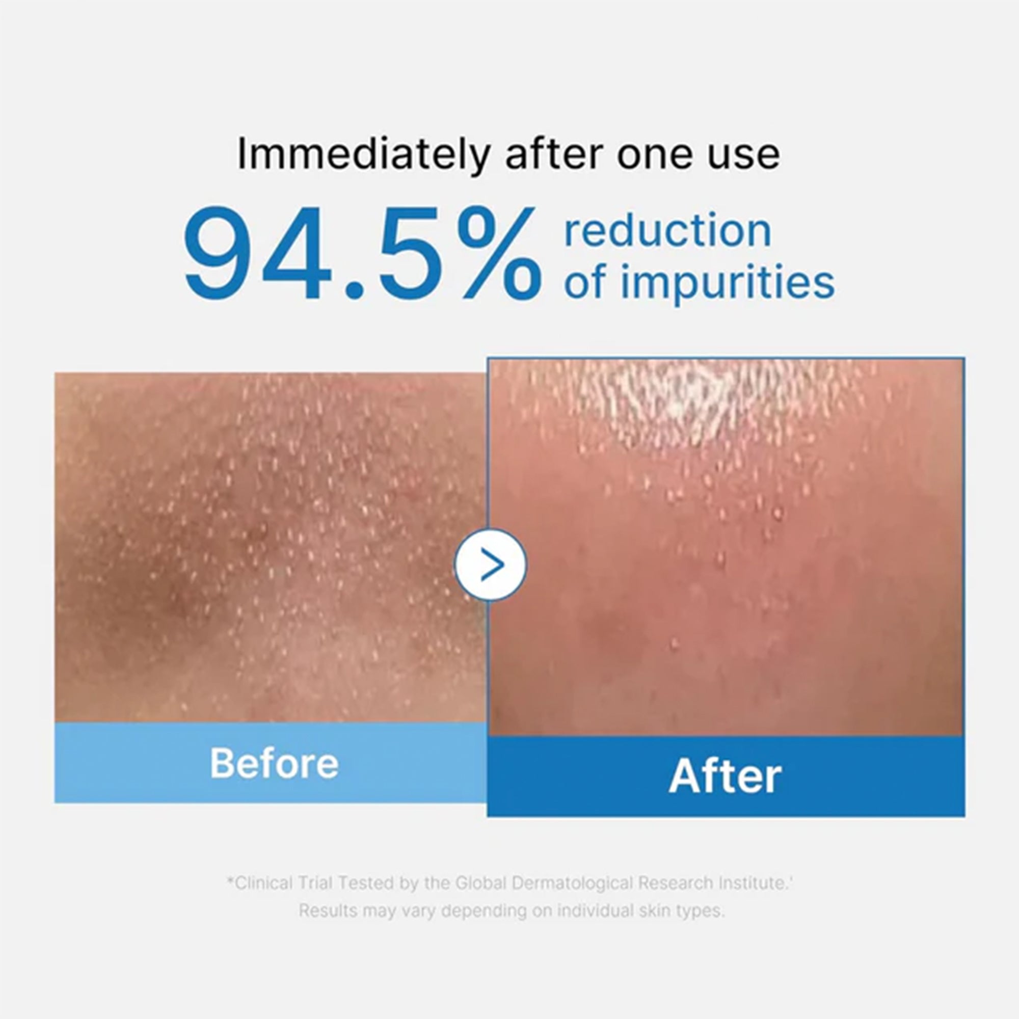 Medicube Zero Pore Blackhead Cleansing Oil 205ml Tube