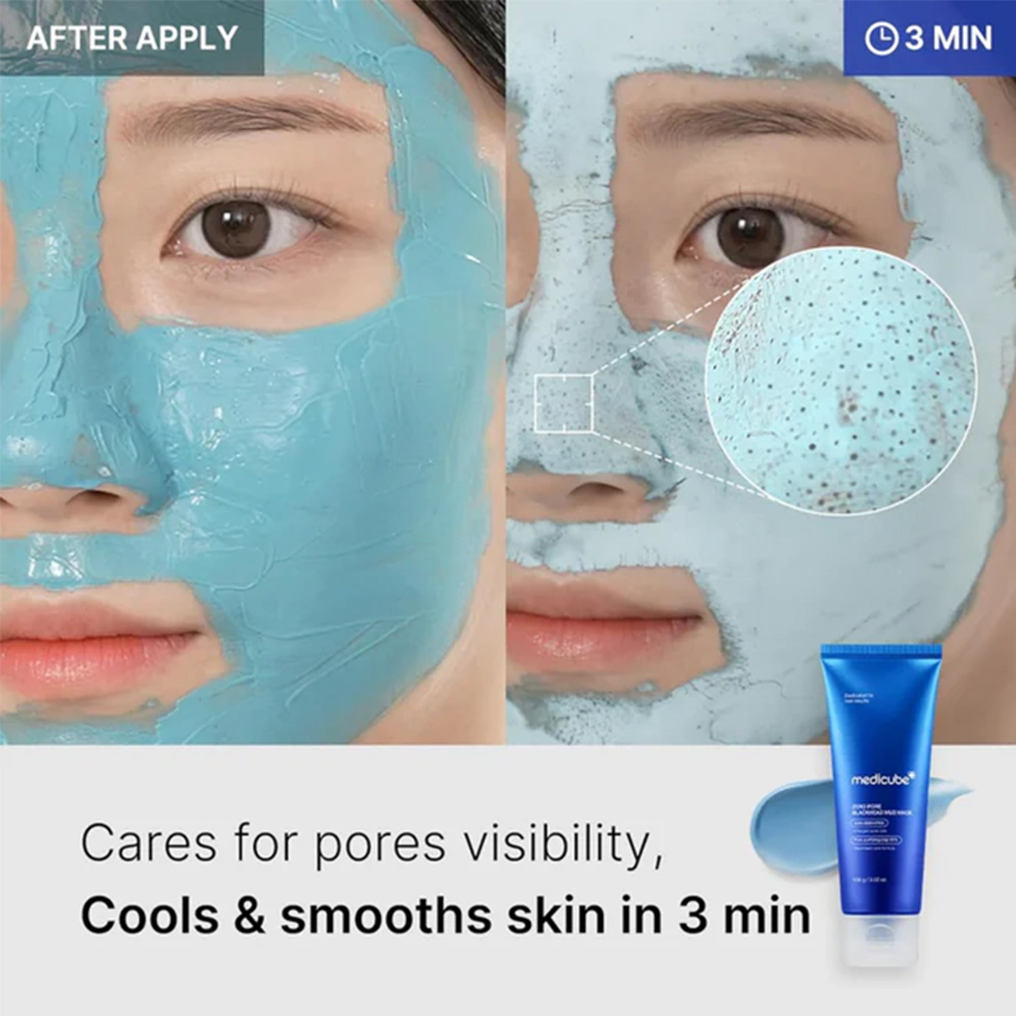 Medicube Zero Pore Blackhead Mud Mask 100ml Tube